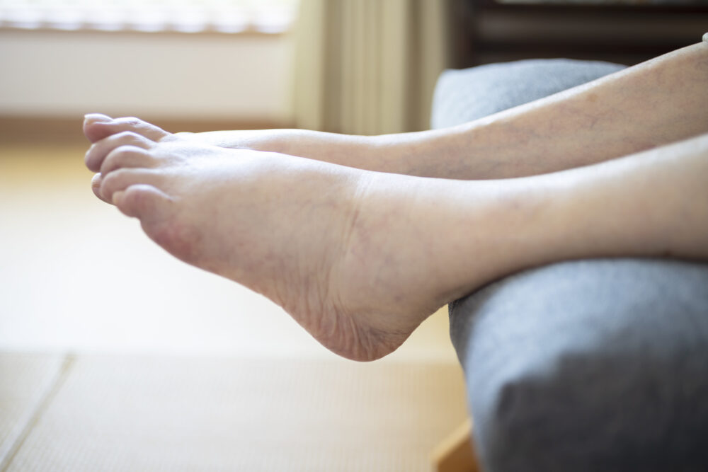 糖尿病神経障害